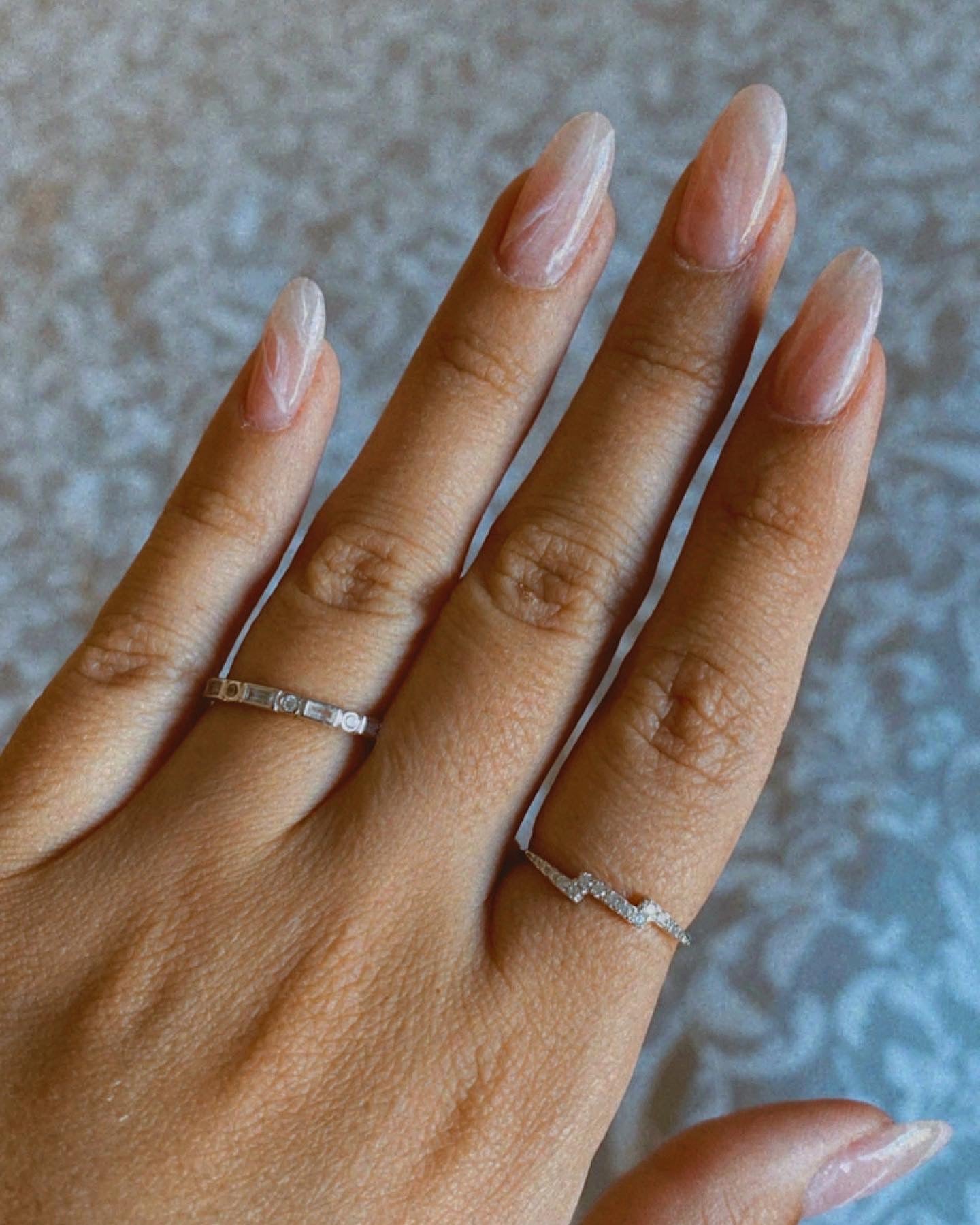 Anillo Neu